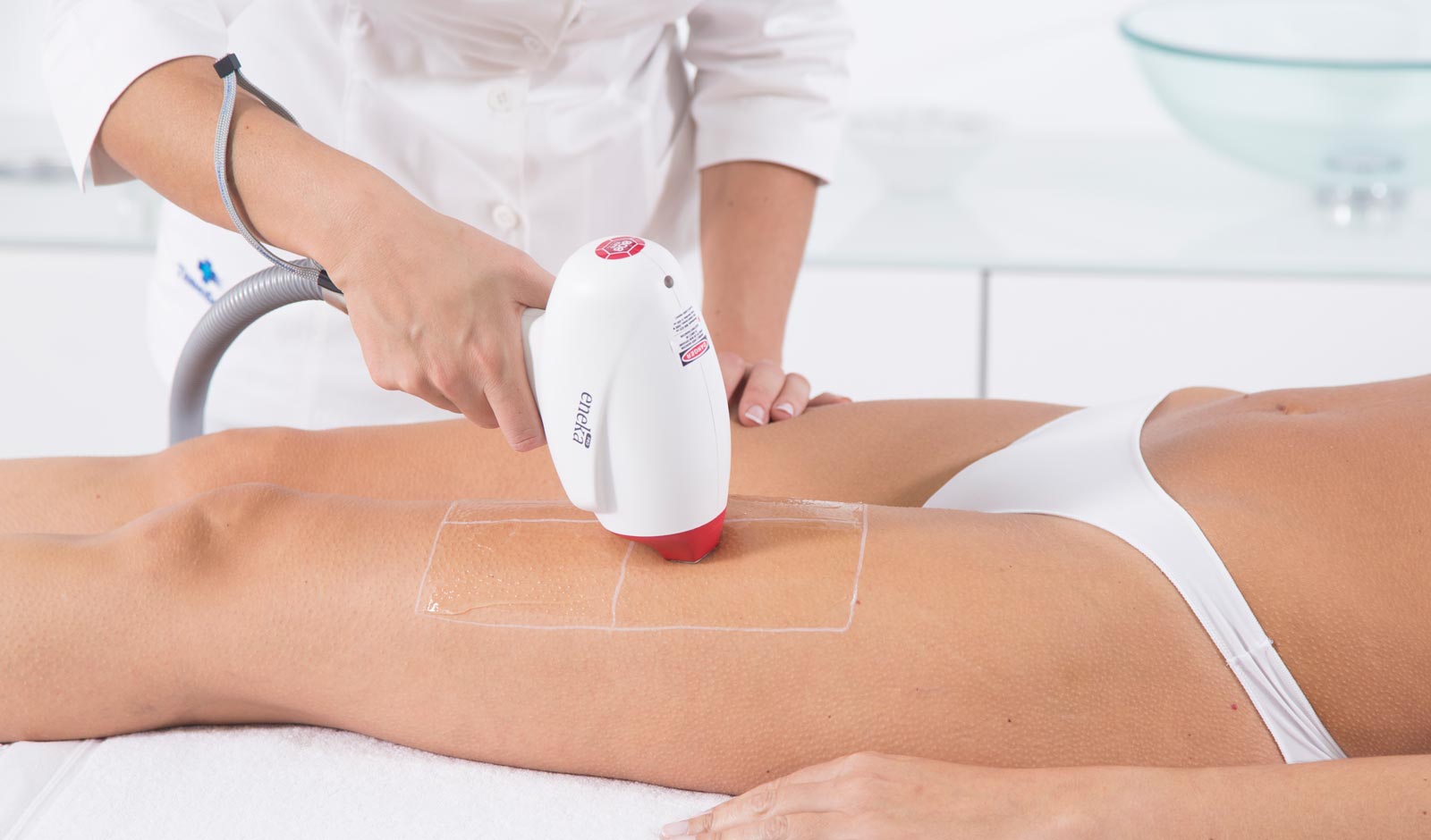 treatment-laser-legs